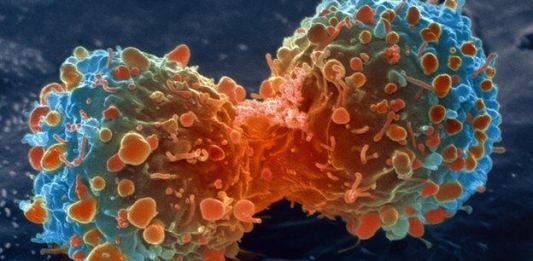 cancer-treatment-delhi